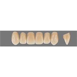 Physiodens 3D Anterior Shade 2L1.5 Upper Mould O5L Set 6