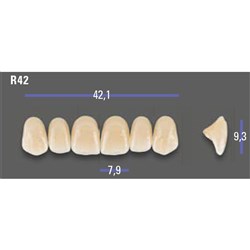 MFT Upper Anterior 3D MASTER Shade 1M1 Mould R42 x6