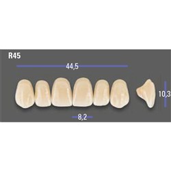 MFT Upper Anterior 3D MASTER Shade 1M1 Mould R45 x6