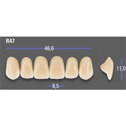 MFT Upper Anterior 3D MASTER Shade 1M1 Mould R47 x6