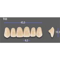 MFT Upper Anterior 3D MASTER Shade 2L15 Mould T43 x6