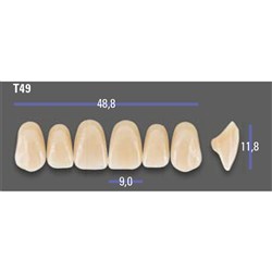 MFT Upper Anterior 3D MASTER Shade 2L15 Mould T49 x6