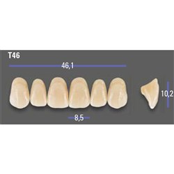 MFT Upper Anterior 3D MASTER Shade 3R25 Mould T46 x6