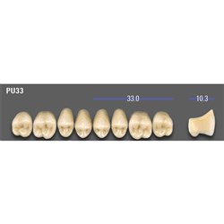 VITA MFT Upper Posterior Classical Shade A1 Mould PU33