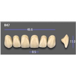 VITA MFT Upper Anterior Classical Shade A1 Mould R47