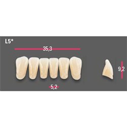 Vitapan Anterior Shade A2 Lower Mould L5 Set 6