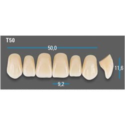 Vitapan Plus Upper Anterior Shade A2 Mould T50 Classical