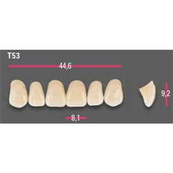 Vitapan Anterior Shade A2 Upper Mould T53 Set 6