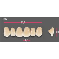 Vitapan Anterior Shade A3.5 Upper Mould T56 Set 6