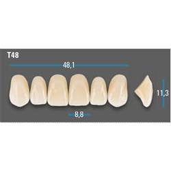 Vitapan Plus Anterior Shade B3 Upper Mould T48 Set 6
