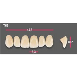 Vitapan Anterior Shade C1 Upper Mould T66 Set 6