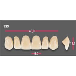 Vitapan Anterior Shade D2 Upper Mould T99 Set 6
