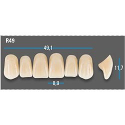 Vitapan Plus Anterior Shade D3 Upper Mould R49 Set 6