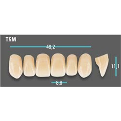 Physiodens Anterior Shade A2 Upper Mould T5M Set 6