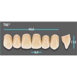 Physiodens Anterior Shade A2 Upper Mould T8L Set 6