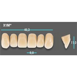 Physiodens Anterior Shade A3.5 Upper Mould X1M Set 6