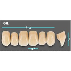 Physiodens Anterior Shade A4 Upper Mould O6L Set 6