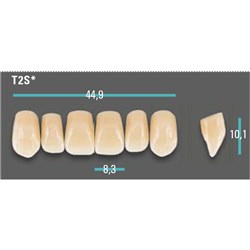 Physiodens Anterior Shade A4 Upper Mould T2S Set 6