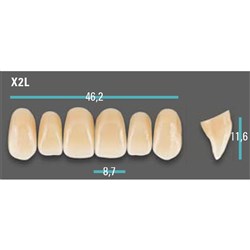 Physiodens Anterior Shade A4 Upper Mould X2L Set 6
