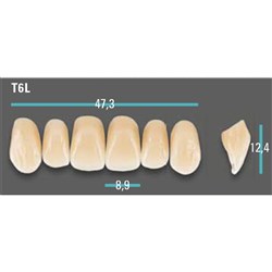 Physiodens Anterior Shade B2 Upper Mould T6L Set 6