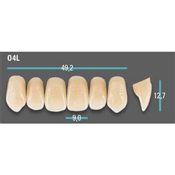 Physiodens Anterior Shade B3 Upper Mould O4L Set 6