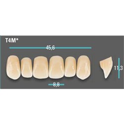 Physiodens Anterior Shade B3 Upper Mould T4M Set 6