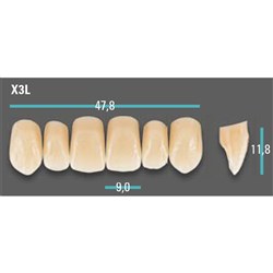 Physiodens Anterior Shade B3 Upper Mould X3L Set 6