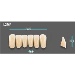 Physiodens Anterior Shade C1 Lower Mould L2M Set 6