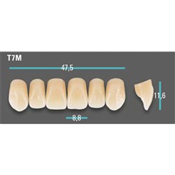 Physiodens Anterior Shade C3 Upper Mould T7M Set 6