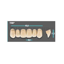Physiodens Classical Anterior Shade D4 Upper Mould T4M Set 6