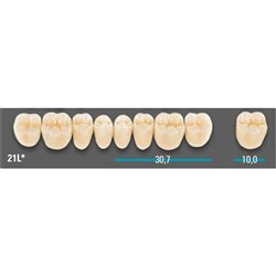 VITA Lingoform Lower Posterior Shade 1M1 Mould 22LL 3D-MASTER