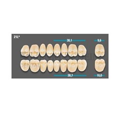 VITA Lingoform Lower Posterior Shade 2M1 Mould 21LL 3D-MASTER