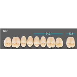 VITA Lingoform Upper Posterior Shade A1 Mould 23L Classical