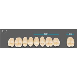 VITA Lingoform Upper Posterior Shade A4 Mould 21L Classical