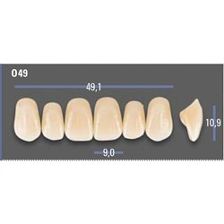 VITAPAN EXCELL Classical Upper Anterior Shade A2 Mould O49