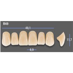 VITAPAN EXCELL Classical Upper Anterior Shade A4 Mould R49
