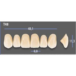VITAPAN EXCELL Classical Upper Anterior Shade C1 Mould T48